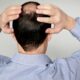 3 Insights for Men Struggling with Male Pattern Baldness