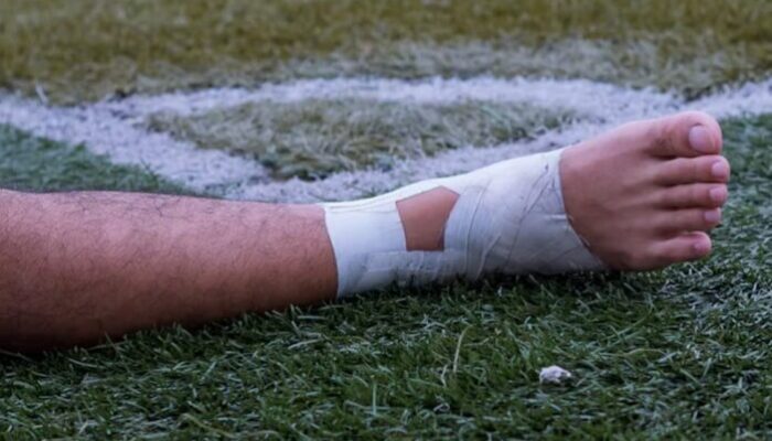 Sport Safety: 4 Common Sports Injuries and How to Treat Them (2023)