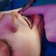 Understanding the Importance of Orthodontic Retainers