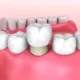 Unveiling The Brilliance Of Zoom! Teeth Whitening 