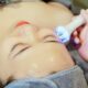 7 Top Benefits of Facelift